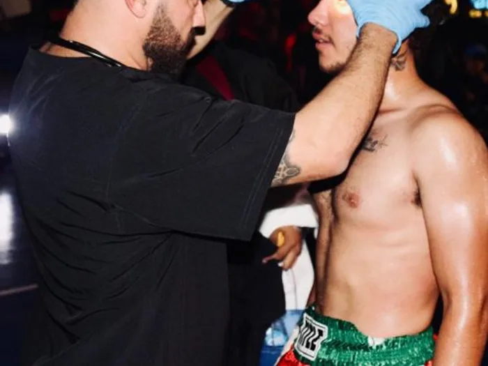 El Dr. Grimaldo revisando el ojo de un boxeador entre rounds